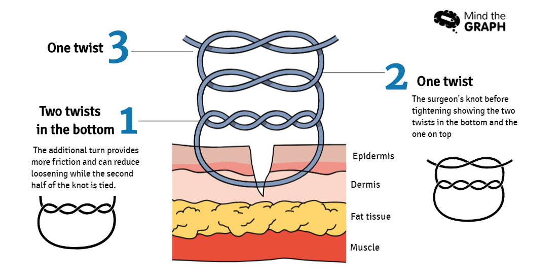 medical illustrations surgeon knot